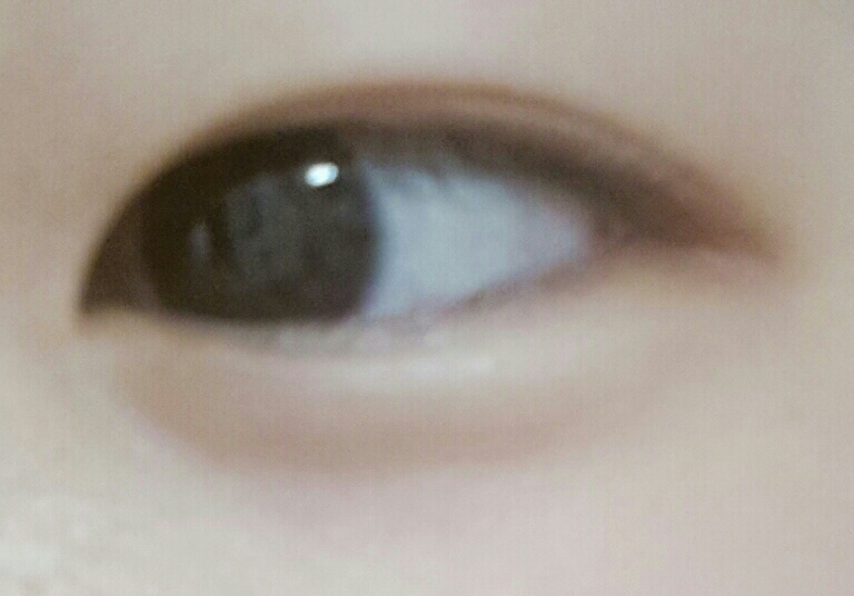 쌍액을 하고 라인까지 잡았는데 쌍커풀이 제대로 안되보인다!
하시면 Y자스틱으로 하면 달라붙잖습니까? 면봉사용하면 안붙음ㅋ
그리고 쌍액하기전에 눈두덩이에 기름기라거나 수분이있으면 없애고 하귀 ~