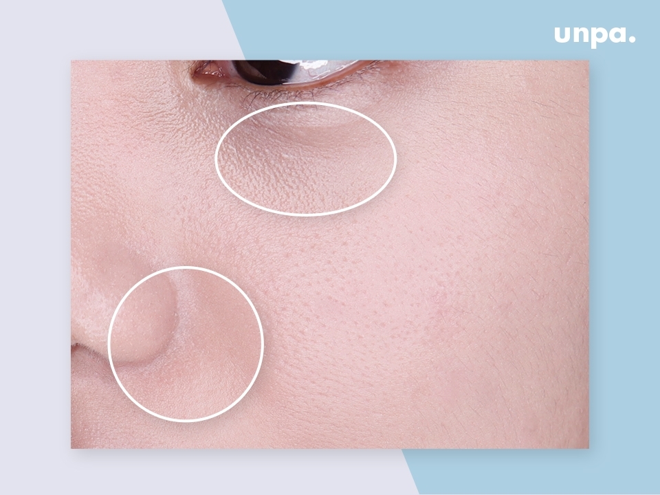 노화의 시작은 반오십부터 라더니… 세상에, 점점 그걸 
몸소 체감하고 있는거야ㅠ_ㅠ 푹 자도 퀭해 보이고 
눈 밑 주름에 파데가 끼기 시작하고… 이것저것 써보다가 
다 2%씩 아쉽길래 결국엔 유세린 아이크림으로 돌아왔지
