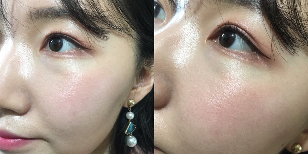 이번엔 얼굴에 테스트를 진행해보았어요!


우선 유분 폭발한 제 얼굴을 준비해줄게요ㅎㅎ

화장 직후가 아닌, 일부러 학교 다녀와서 수정화장없이 유분기가 많은 상태에서 테스트를 했어요!


저는 평소에 수분부족형지성타입으로, 파우더 없이는 못사는, 특히 이마와 코는 어마무시한 산유국이라 아쥬 번쩍번쩍하더라구요!