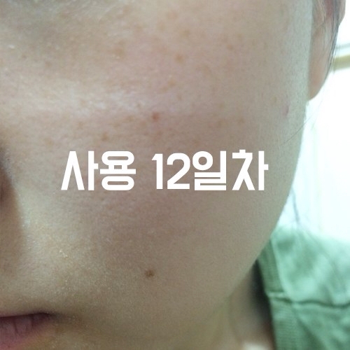 3일차까지 쓰고 중단 후 일주일정도 쉰다음에 다시 바르기 시작했는데 뭔가 처음 바를때랄은 흡수되는 느낌이 달랐어요 ㅋㅋ