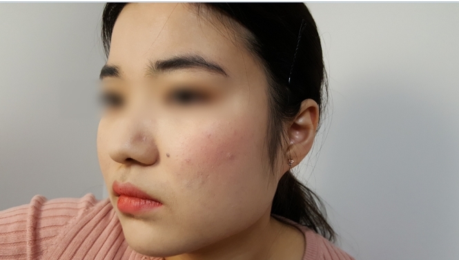 상큼하고 이쁘지않나요??ㅎㅎ 이제 곧봄이니 유용하게 쓰일수 있는 블러셔인것 같습니다. 
색이 너무 예뻐요!!♡♡