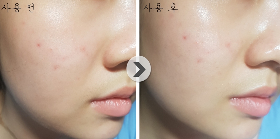 피부이 발랐을때도 끈적임보다 촉촉하고 쫀쫀한 느낌을 받았어요!또 피부에 자연스러운 광이 돌아서 피부화장도 잘먹을 것 같아요!!