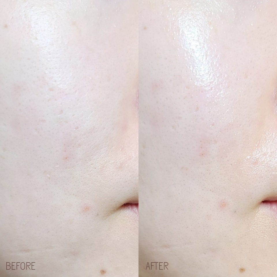 단번에 뿜어져나오는 수분 광채는 비포 애프터로 보면 더 극명하죠?

​

안티에이징 제품이 무겁지 않은거 만으로도 땡큐인데 보습감까지 좋아부렸...

​

세라베리옴 앰플 프렙 에센스는 데일리 케어로 정말 찐추입니다👍👍👍

