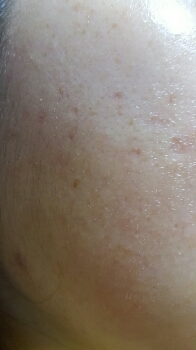 바르기전 모습이에요
클렌징티슈로 지워서 반들반들하네요 ㅎㅎ