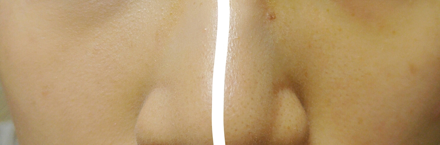 짠. 이렇게 보면 변화가 더 확실하답니다~!