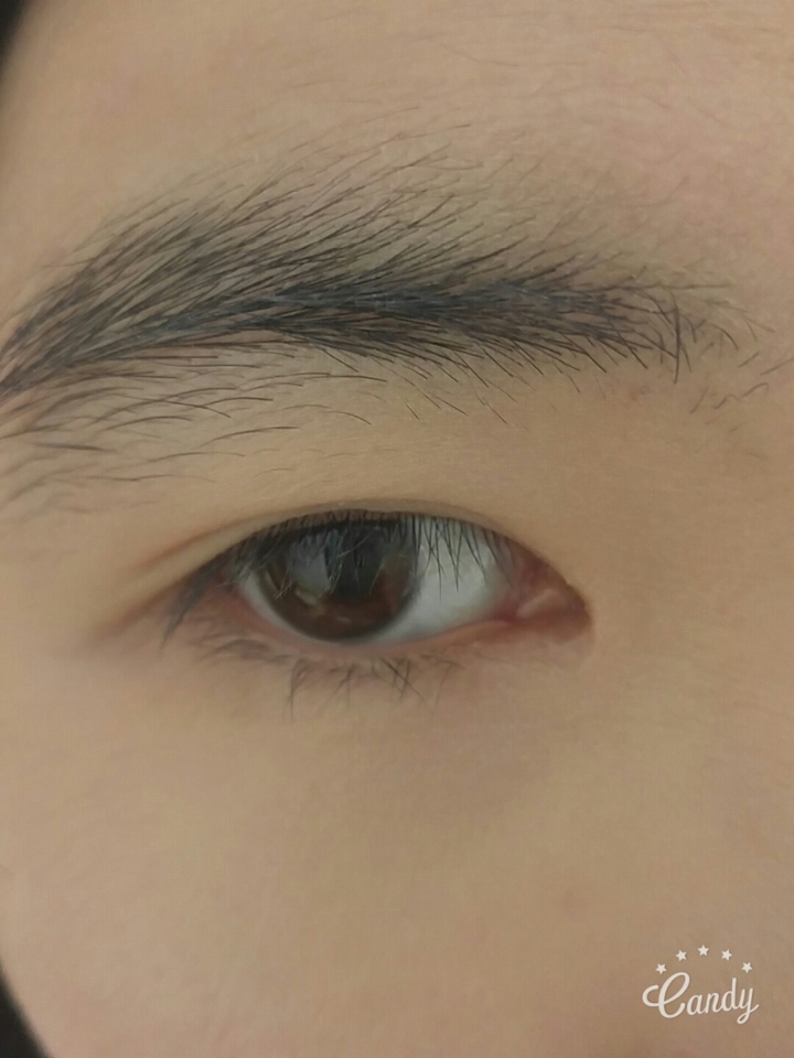 아무것도 안한 생눈인데요 눈썹 처진거 보이시죠?
