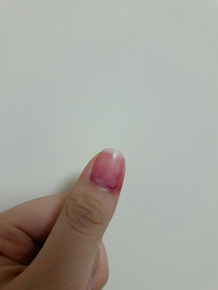 베이스X. 아세톤으로 지웠을 때예요... 누구나 한 번쯤은 이러신적 있으시죠?