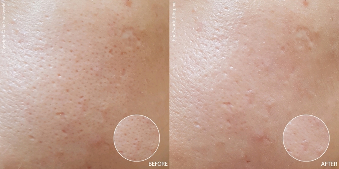 
거기다가 모공과 요철까지 잡아준다는 사실!!!!
모공 부자들 소리 질뤄어어어어엇~٩( >ω< )و 
​
자잘한 모공들이 꼼꼼히 메워진거 보이시죠? 
​
안 메워진 모공은 제품 문제가 아닙니다...
제 왕모공과 더러운 피부 탓이죠 엉엉( ´•̥̥̥ω•̥̥̥` )



자외선 차단 + 자연스러운 톤업 + 모공/요철/피부결 보정 
이 세 가지 기능을 하나로 모은 제품이 
바로 정샘물의 스킨 세팅 톤업 선 베이스에요! 
​
피부 좋으신 분들은 이거 하나만 바르고 나가셔도 돼요. 
​
선크림만 바르고 나가기엔 부끄럽고, 
그렇다고 파운데이션으로 풀메이크업하기는 부담될 때, 
요고 하나면 베이스 메이크업 끝! 
✧*｡٩(ˊωˋ*)و✧*｡



그렇지만! 
전 아니니까요! 
파데 없인 못 싸라아아아아(๑´Д`ก)
​
​
그래서 파운데이션을 발라 봤습니다 
​
정샘물 톤업베이스를 바른 꿀광 피부 위에 
더페이스샵 잉크래스팅 파운데이션 슬림핏 N201을 챱챱! 

(다른 제품은 일체 사용하지 않았어요.)
