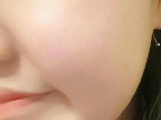 사용한 뒤 모습입니다~ 특별히 달라지는점은 없었으나 꾸준히 사용하면 좋을 것 같아요~