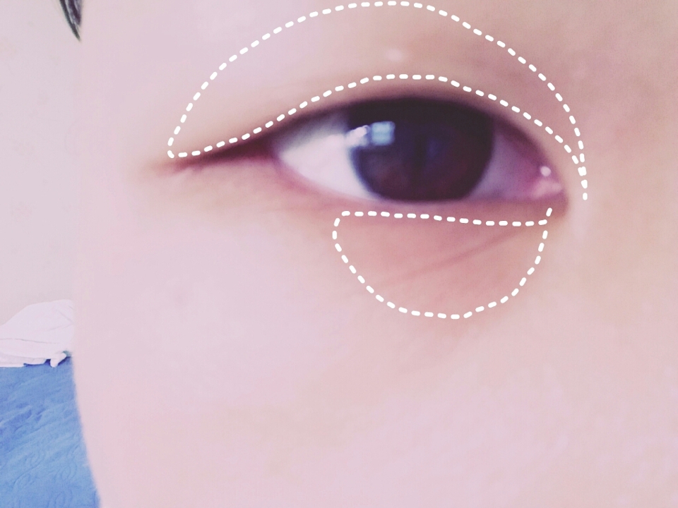 컨실러?뭐하러사나요
우리에겐 썬크림이있습니다!
썬크림으로 다크써클을 없앰과동시에 눈두덩이에 베이스로깔아줍니다(좀나이졌죠?)