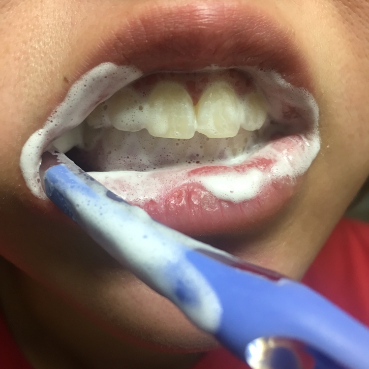 뷰센 H치약이 거품이 막 풍부한 타입은 아니에요
향도 시트러스향?인데 강하지 않아서 좋았어요
제가 또 잇몸이 약해서 강한 치약은 이가 시려서요