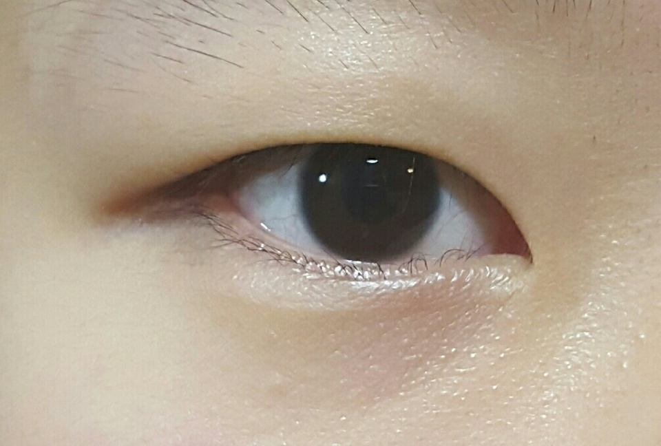 전 전형적인 지방많고 선없는 무쌍 눈입니당