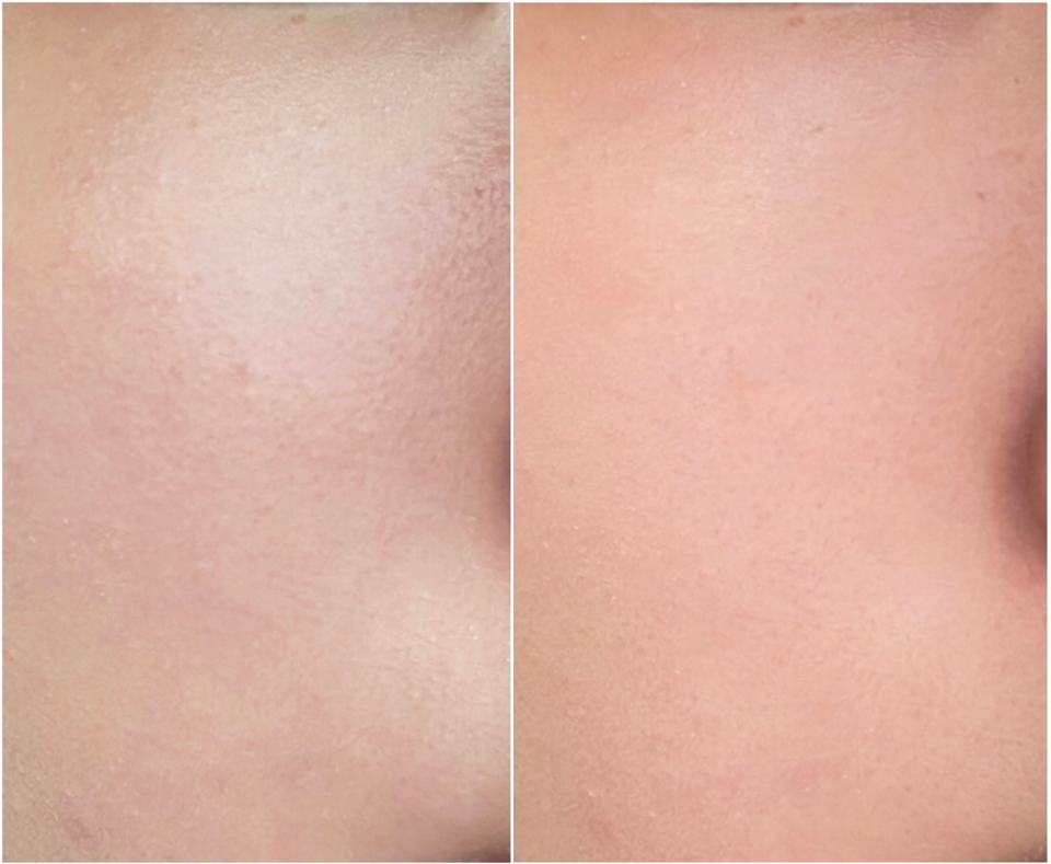 이렇게 파우더로 마무리 해주면 유분기가 잡혀서 피부가 정말 보송해져요! 요철이나 모공도 부각이 되지않아서 훨씬 더 깨끗해보이는 효과가 있더라구요
파우더는 정말 베이스에서 빠질 수 없는 요소인 것 같아요

[꿀팁 정리]

✨퍼프에 적당량을 묻혀 이마, 코 부터 두드려준 뒤 남은 파우더를 볼과 턱에 두드려주기

✨눈가와 눈썹도 빼먹지말고 적은 양의 파우더로 쓸어주듯이 유분기 제거해주기! 